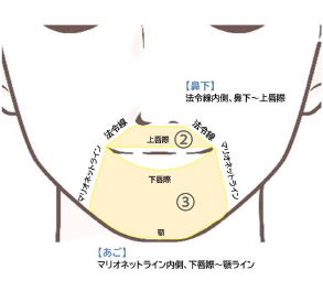 パーツ別脱毛